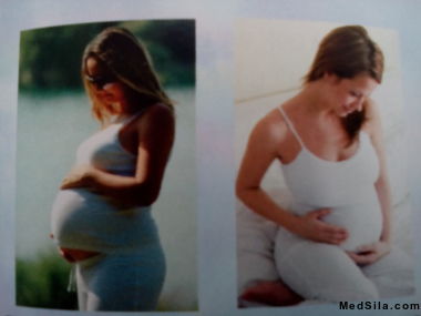 Беременная женщина